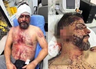 MATO GROSSO: assalto à casa de vereador em Rondonópolis deixa família agredida e refém